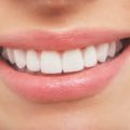 Snowhite Teeth Whitening – kako funckcionira – ebay – forum